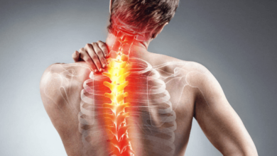 What You Need to Know About Whiplash: Spotting Nerve Damage Symptoms