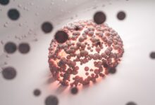 why kialodenzydaisis kills matters